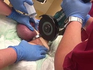 Wie nicht zu entfernen A Cock Ring!
