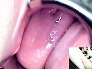 Adalynnx - Reflector endoscopio hitachi vibratore sperma