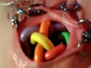 Extremely Bizarre Eroded Vaginal Insertions Mother